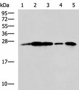 Western blot analysis of A549 cell Rat brain tissue Mouse brain tissue A172 cell Human cerebrum tissue lysates using UCHL1 Polyclonal Antibody at dilution of 1:800
