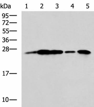 Western blot analysis of A549 cell Rat brain tissue Mouse brain tissue A172 cell Human cerebrum tissue lysates using UCHL1 Polyclonal Antibody at dilution of 1:800
