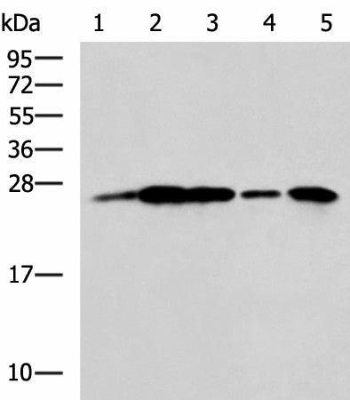 Western blot analysis of A549 cell Rat brain tissue Mouse brain tissue A172 cell Human cerebrum tissue lysates using UCHL1 Polyclonal Antibody at dilution of 1:800