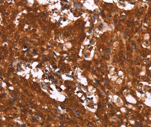 Anti-Human/Mouse/Rat HCAR2 Antibody