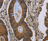 Anti-Human NEFH Antibody - ABMIUM