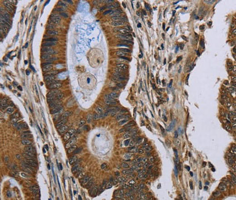 Anti-Human NEFH Antibody - ABMIUM