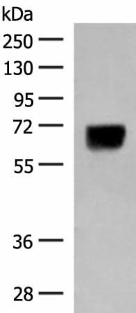 Western blot analysis of Human thyroid tissue lysate using DGLUCY Polyclonal Antibody at dilution of 1:250