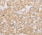 Anti-Human/Rat ATG9A Antibody - ABMIUM