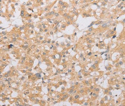 Anti-Human/Rat ATG9A Antibody - ABMIUM