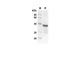 SDS-PAGE analysis of Human GROβ/CXCL2 proteins, 2 μg/lane of Recombinant Human GROβ/CXCL2 proteins was resolved with an SDS-PAGE under reducing conditions, showing bands at 33.9 kDa.