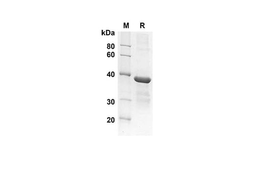 SDS-PAGE analysis of Human GROβ/CXCL2 proteins, 2 μg/lane of Recombinant Human GROβ/CXCL2 proteins was resolved with an SDS-PAGE under reducing conditions, showing bands at 33.9 kDa.