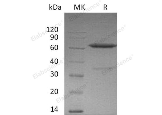 Recombinant Mouse Ephrin-A3/EFNA3 Protein (Fc Tag) - ABMIUM