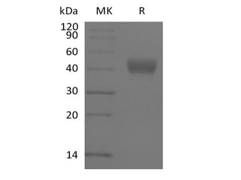 Recombinant Human ADP-ribosyl Cyclase/cyclic ADP-ribose Hydrolase 1/CD38 (N-6His-Avi) Biotinylated - ABMIUM