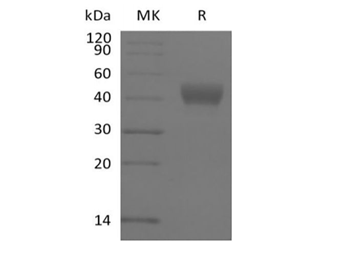 Recombinant Human ADP-ribosyl Cyclase/cyclic ADP-ribose Hydrolase 1/CD38 (N-6His-Avi) Biotinylated - ABMIUM