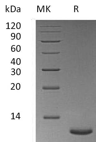 Recombinant Mouse Trefoil Factor 3/TFF3 Protein (His Tag) - ABMIUM