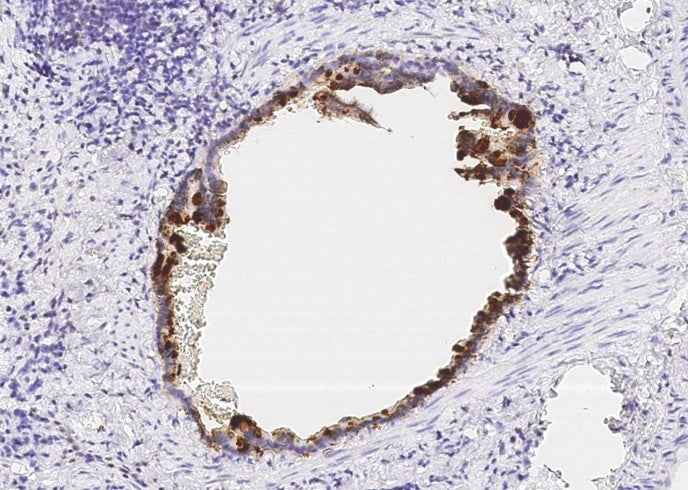 Anti-Rat WFDC2 Antibody [B518] - ABMIUM