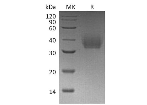 Recombinant Mouse IL-21R Protein (His Tag) - ABMIUM