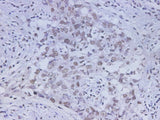 Anti-Human HMGB-1 Antibody - ABMIUM