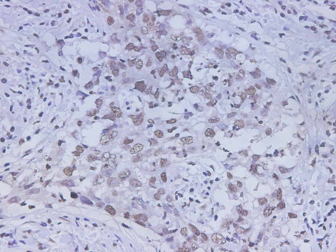 Anti-Human HMGB-1 Antibody - ABMIUM