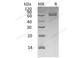 Recombinant Human TGOLN2/TGN38 Homolog Protein (His Tag) - ABMIUM