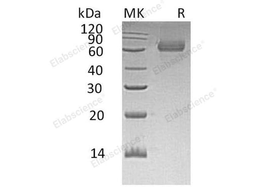 Recombinant Human TGOLN2/TGN38 Homolog Protein (His Tag) - ABMIUM