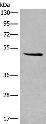 Western blot analysis of HL-60 cell lysate using SPOCK3 Polyclonal Antibody at dilution of 1:400