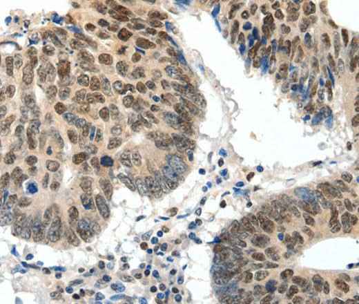 Anti-Human/Mouse/Rat TOP2A Antibody