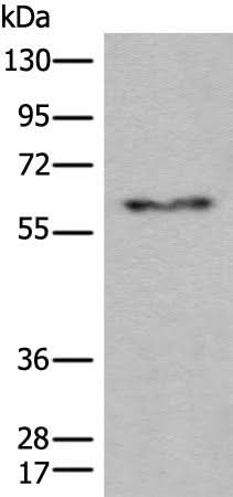 Western blot analysis of Human fetal liver tissue lysate using CES2 Polyclonal Antibody at dilution of 1:600