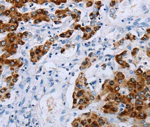 Anti-Human/Mouse NDUFA12 Antibody