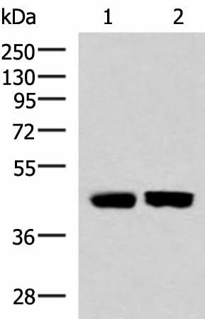Western blot analysis of Human fetal liver tissue and Human liver tissue lysates using KIR3DL1 Polyclonal Antibody at dilution of 1:1000