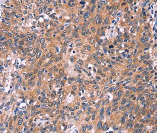Anti-Human EDN1 Antibody