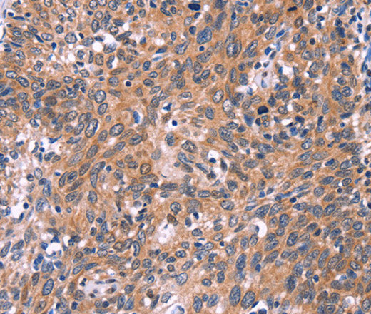 Anti-Human EDN1 Antibody - ABMIUM