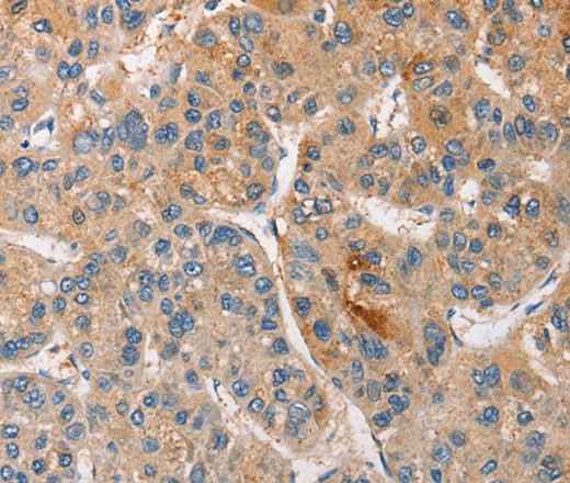 Anti-Human/Rat CCL4 Antibody