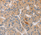 Anti-Human/Rat CCL4 Antibody - ABMIUM