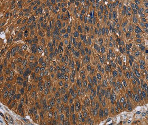 Anti-Human FCGR3A Antibody - ABMIUM