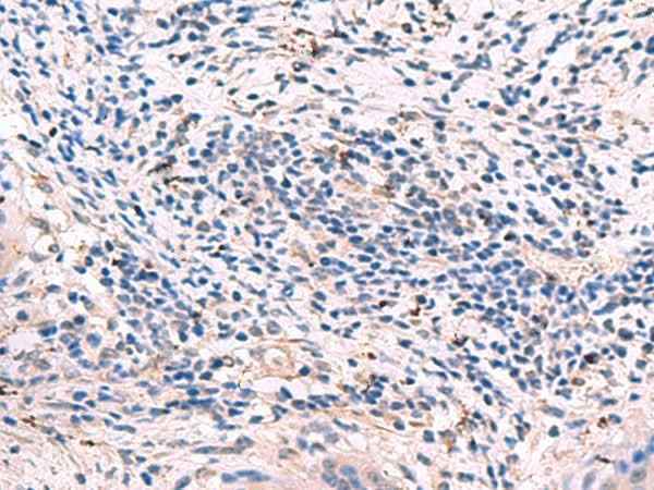 Anti-Human/Mouse/Rat GKAP1 Antibody