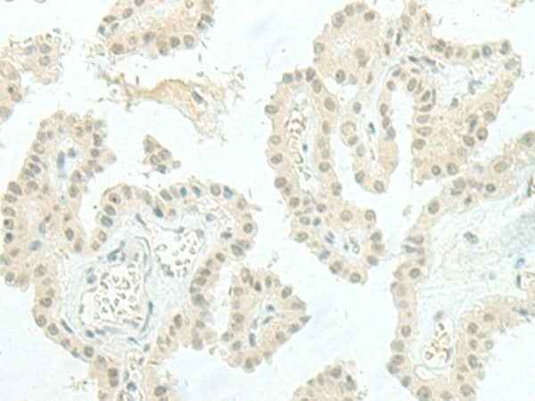 Anti-Human/Mouse/Rat ESRP2 Antibody