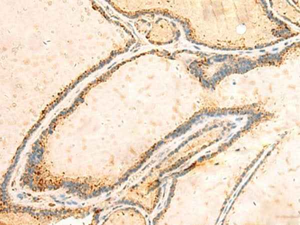 Anti-Human IGFBPL1 Antibody