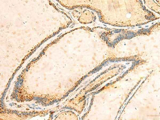 Anti-Human IGFBPL1 Antibody