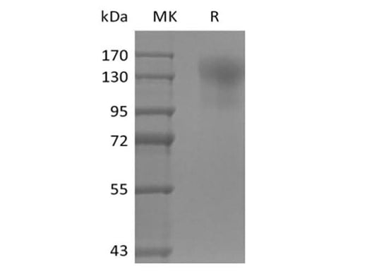 Recombinant Mouse CD45/PTPRC (C-6His) - ABMIUM