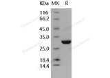 > 96 % as determined by reducing SDS-PAGE.