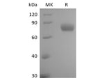 Recombinant Human Leukocyte Ig-Like Receptor B1/ LILRB1/ILT2/CD85j (C-6His-Avi) Biotinylated - ABMIUM
