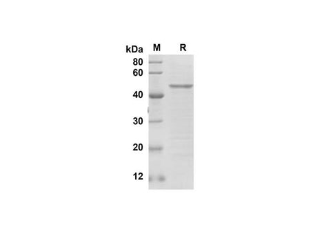 SDS-PAGE analysis of Human SNAI1 proteins, 2 μg/lane of Recombinant Human SNAI1 proteins was resolved with SDS-PAGE under reducing conditions, showing bands at 45 kDa.