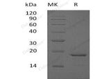 Recombinant Human Glucagon/GCG Protein (His Tag) - ABMIUM