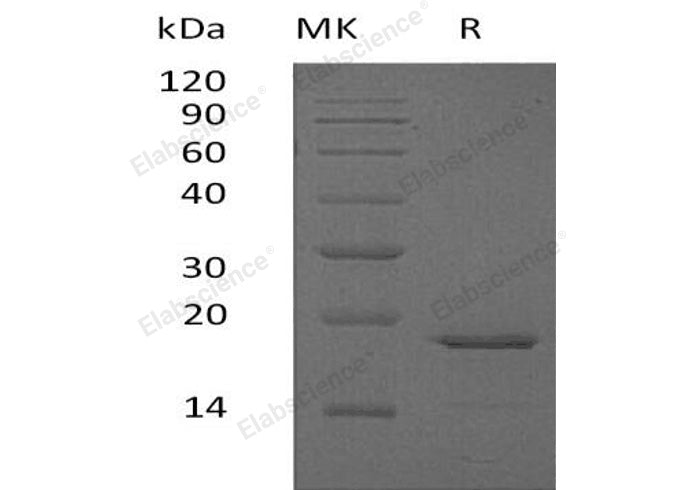 Recombinant Human Glucagon/GCG Protein (His Tag) - ABMIUM