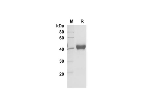 SDS-PAGE analysis of Human IL-5 proteins , 2 μg/lane of Recombinant Human IL-5 proteins was resolved with SDS-PAGE under reducing conditions , showing bands at 41 kDa.