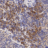 Immunohistochemistry analysis of paraffin-embedded mouse inflammatory spleen using IL2 Polyclonal Antibody at dilution of 1:500.
