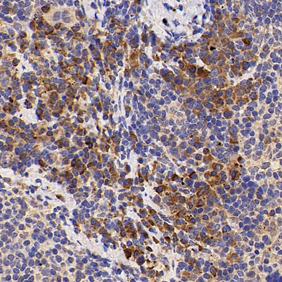 Immunohistochemistry analysis of paraffin-embedded mouse inflammatory spleen using IL2 Polyclonal Antibody at dilution of 1:500.