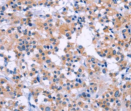 Anti-Human/Mouse DUSP22 Antibody