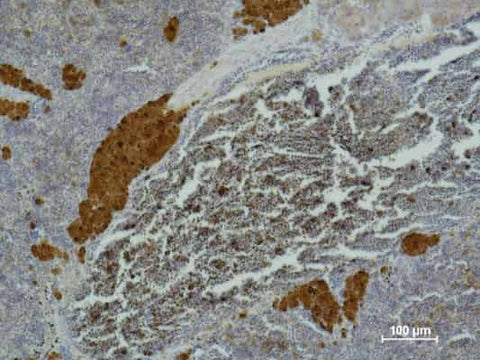 Immunohistochemistry of paraffin-embedded Mouse spleen tissue using IL2RA Monoclonal Antibody at dilution of 1:500 .