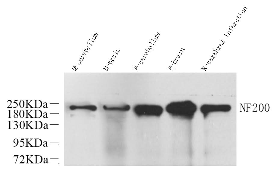 Western Blot analysis of various samples using NEFH Polyclonal Antibody at dilution of 1:1000.