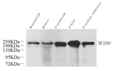 Western Blot analysis of various samples using NEFH Polyclonal Antibody at dilution of 1:1000.