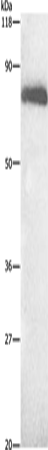 Anti-Human ALB Antibody - ABMIUM