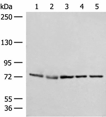 Western blot analysis of A172 231 Jurkat HepG2 and Hela cell lysates using POLH Polyclonal Antibody at dilution of 1:300